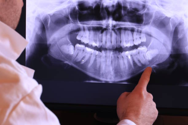 Best Pediatric Emergency Dentist in New Brighton, PA